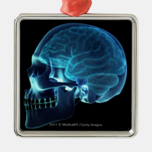 X-ray of the brain inside a skull metal ornament