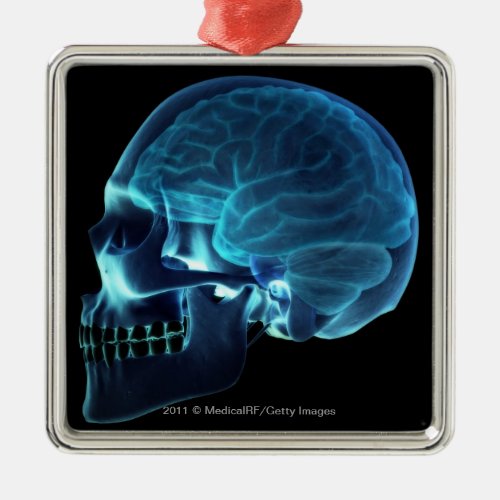 X_ray of the brain inside a skull metal ornament