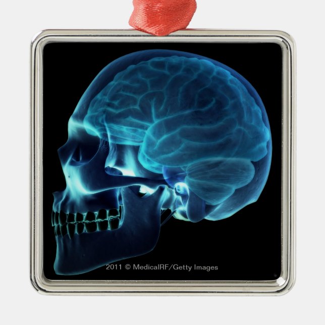 X-ray of the brain inside a skull metal ornament (Front)