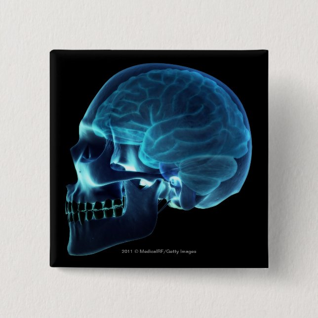 X-ray of the brain inside a skull pinback button (Front)