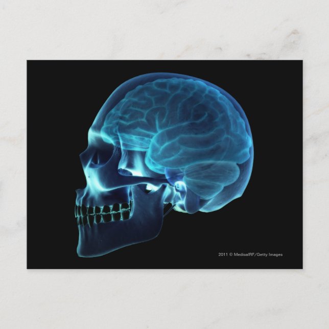 X-ray of the brain inside a skull postcard (Front)