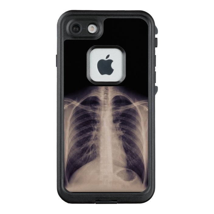 Xray Phone Case