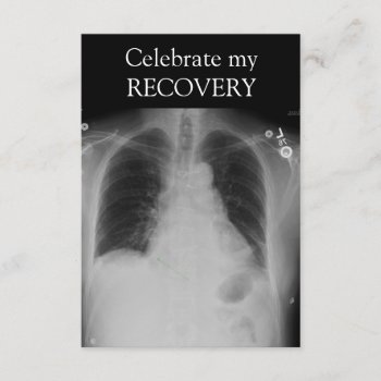 X Ray Recovery ~ Invitation by Andy2302 at Zazzle