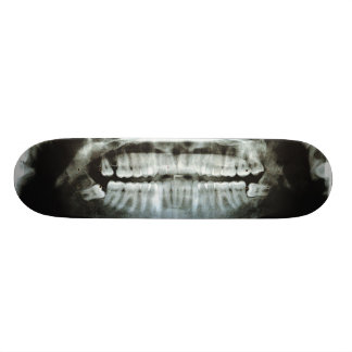 X-Ray Skateboard