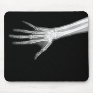 X-RAY SKELETON ARM B&W MOUSE PAD