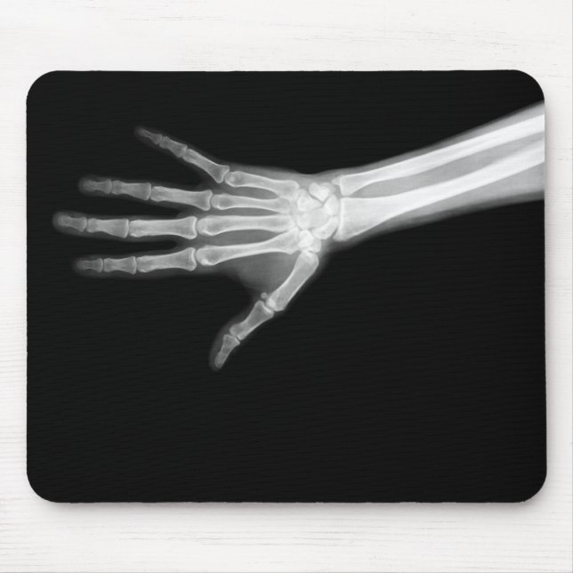 X-RAY SKELETON ARM B&W MOUSE PAD (Front)