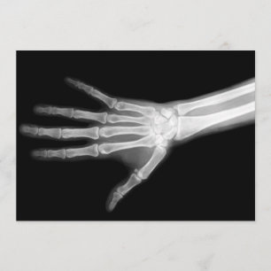 X-Ray Skeleton Arms Black & White Invitation