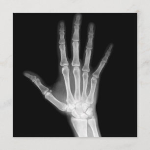 X-Ray Skeleton Arms Black & White Invitation