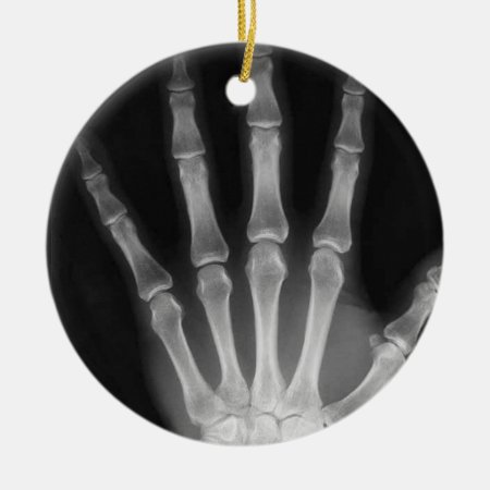 X-ray Skeleton Hand Fingers B&w Ceramic Ornament