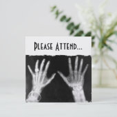 X-Ray Skeleton Hands & Jewelry - B&W (Standing Front)