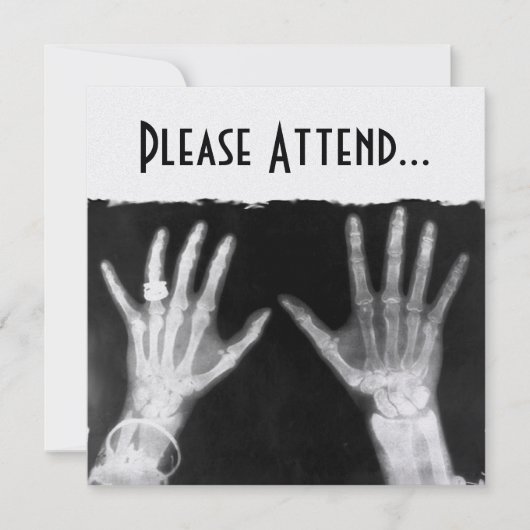 X-Ray Skeleton Hands & Jewelry - B&W (Front)