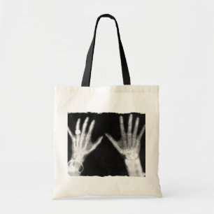 X-Ray Skeleton Hands & Jewelry - B&W Tote Bag