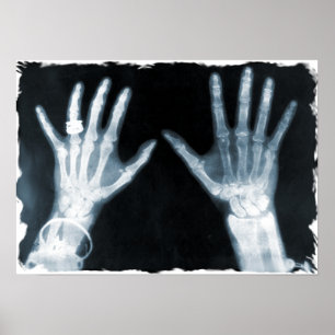 X-Ray Skeleton Hands & Jewelry - Blue Poster