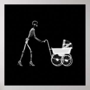 X-Ray Skeleton Mom & Baby - Original B&W Poster