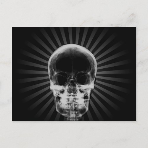 X_Ray Skeleton Skull _ BW Postcard