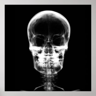 X-Ray Skeleton Skull - B&W Poster