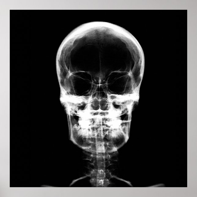 X-Ray Skeleton Skull - B&W Poster (Front)