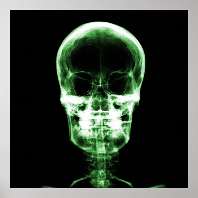 X-Ray Skeleton Skull - Green Poster (Front)