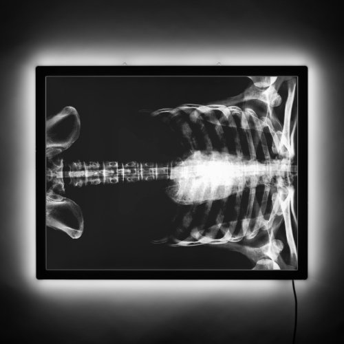 X_Ray Skeleton Torso _ BW LED Sign