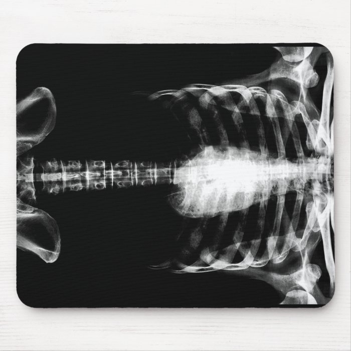 X RAY SKELETON TORSO RIBS   B&W MOUSEPADS