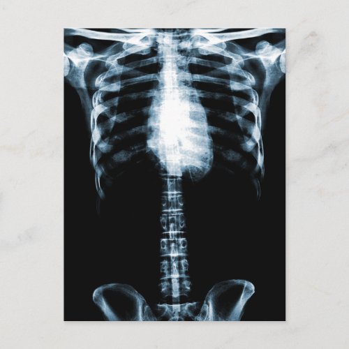 X_RAY SKELETON TORSO RIBS BLUE POSTCARD