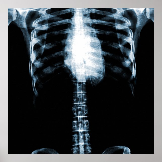 X-RAY SKELETON TORSO RIBS - BLUE POSTER (Front)