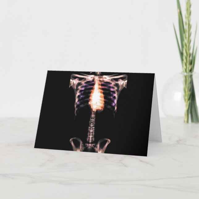 X-RAY SKELETON TORSO RIBS ORIGINAL CARD (Front)