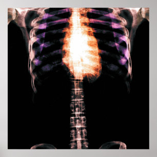 X-RAY SKELETON TORSO RIBS - ORIGINAL POSTER