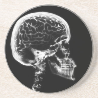 X-RAY SKULL BRAIN - BLACK & WHITE DRINK COASTER