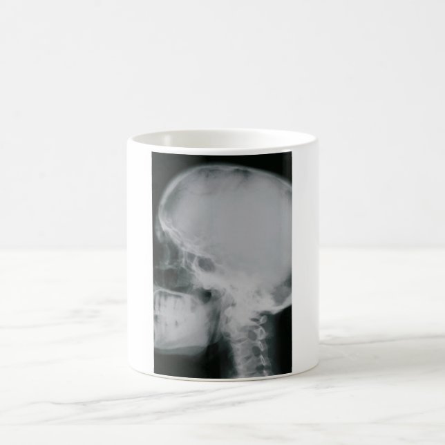 X-Ray Skull Color Morph Mug (Center)