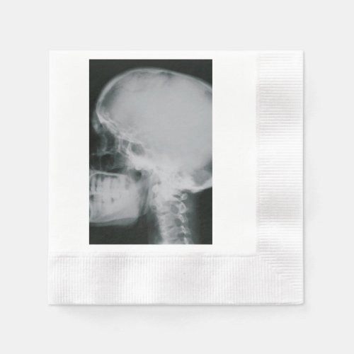 X_Ray Skull Paper Napkins