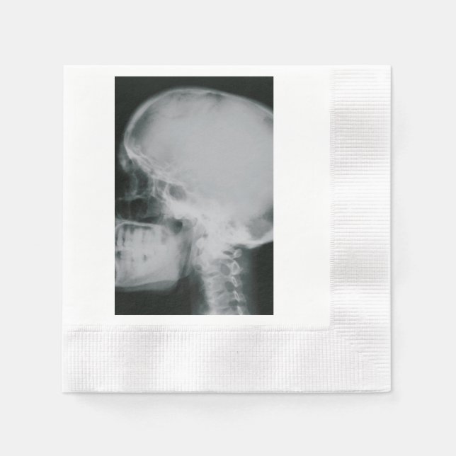 X-Ray Skull Paper Napkins (Front)