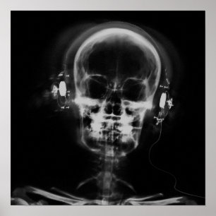 X-Ray Skull with Headphones - B&W Poster