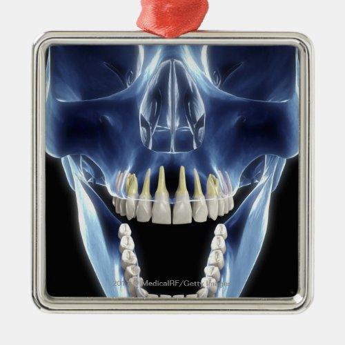 X_ray style look at human teeth metal ornament