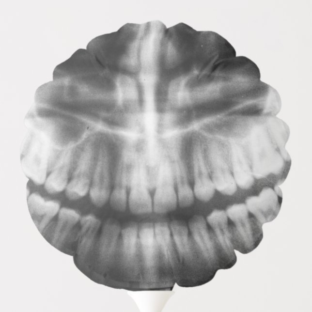 X-Ray Teeth Mouth Smile Black and White Balloon (Back)