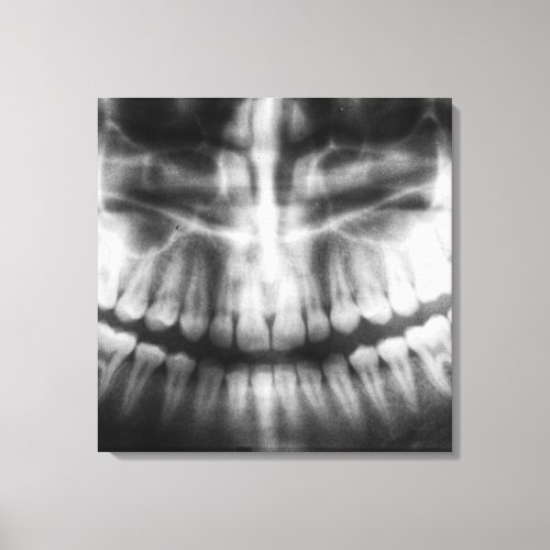 X_Ray Teeth Mouth Smile Black and White Canvas Print