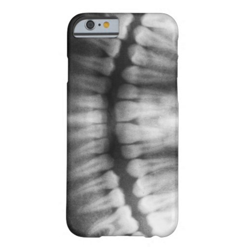 X_Ray Teeth Mouth Smile Black and White Barely There iPhone 6 Case