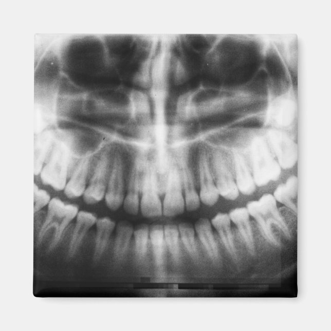 X-Ray Teeth Mouth Smile Black and White Magnet (Front)