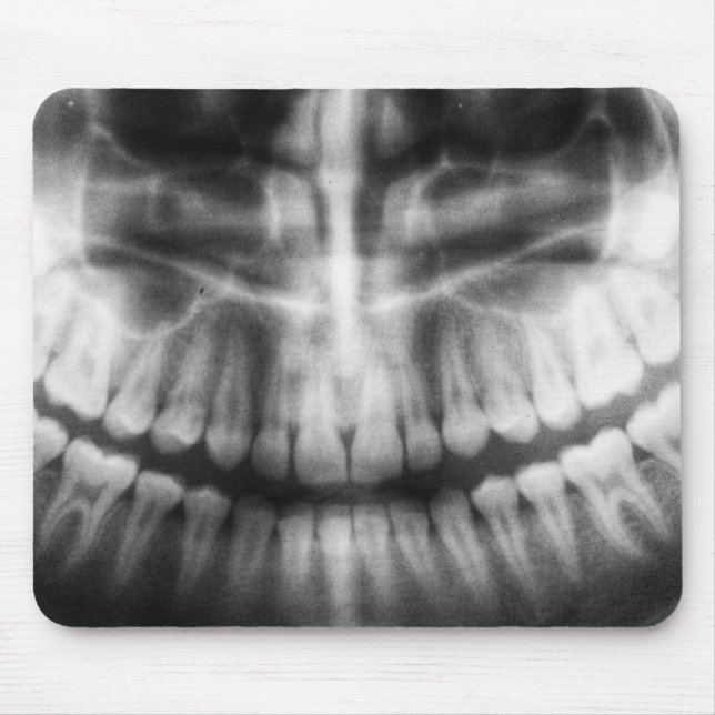 X-Ray Teeth Mouth Smile Black and White Mouse Pad (Front)