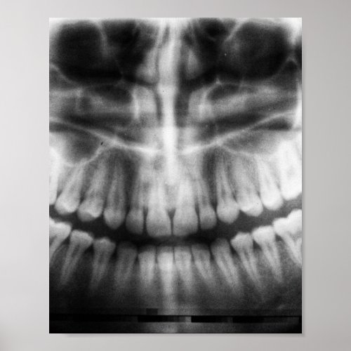 X_Ray Teeth Mouth Smile Black and White Poster