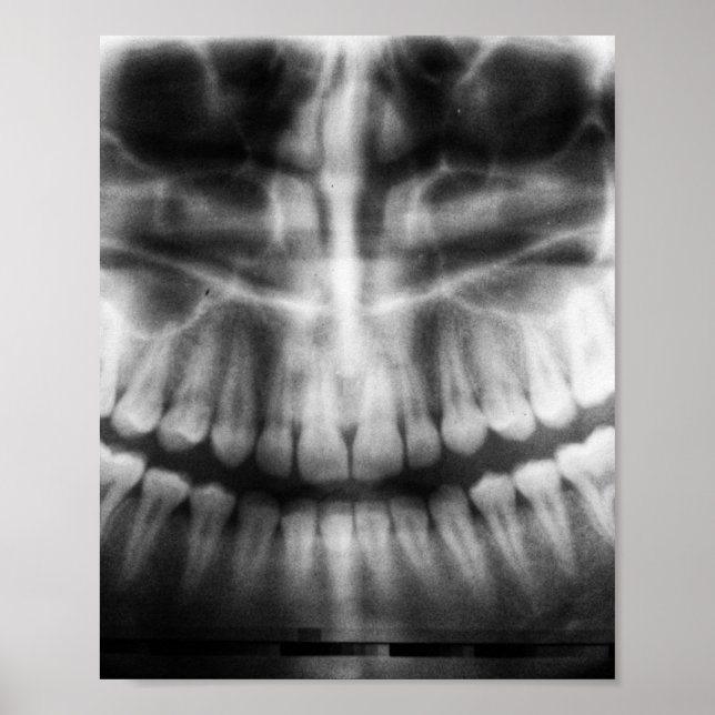 X-Ray Teeth Mouth Smile Black and White Poster (Front)