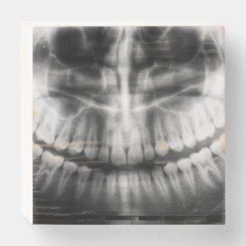 X_Ray Teeth Mouth Smile Black and White Wooden Box Sign