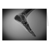 X-Ray View Of Human Foot 4 (Front Horizontal)