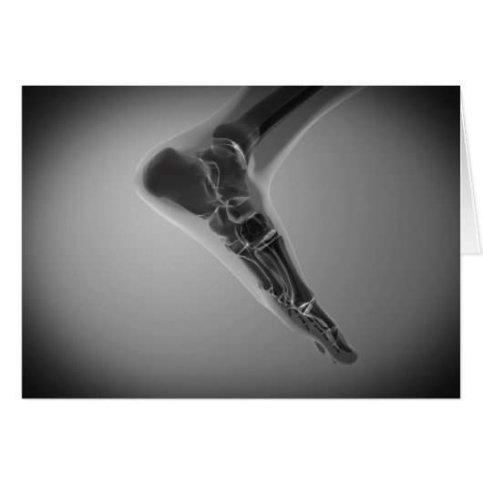 X-Ray View Of Human Foot 4 Cards (Front Horizontal)