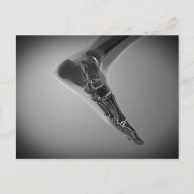 X-Ray View Of Human Foot 4 Postcard (Front)