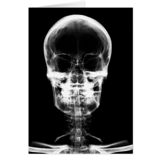 X-RAY VISION SKELETON SKULL - B&W CARDS (Front)