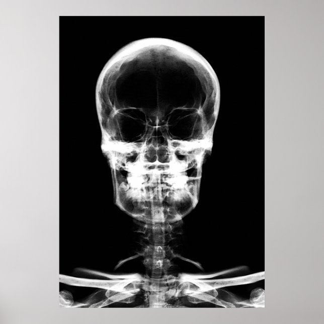 X-RAY VISION SKELETON SKULL - B&W POSTER (Front)
