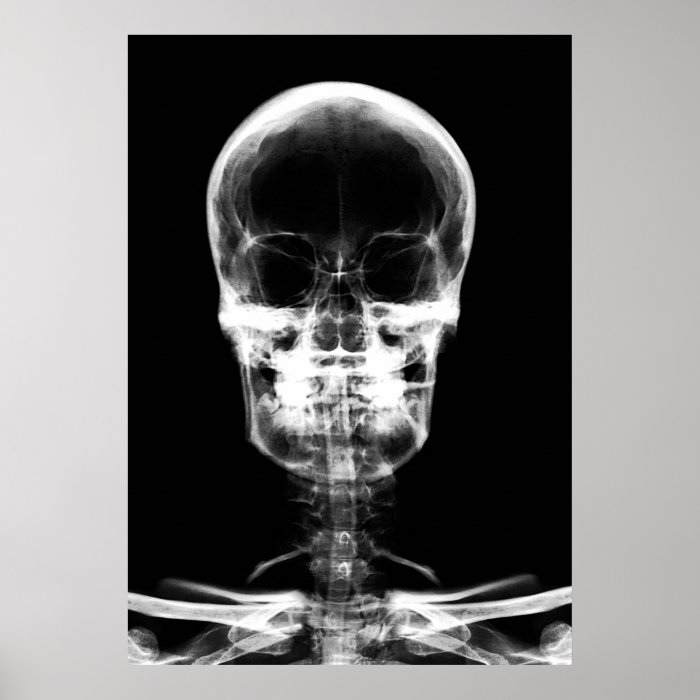 X RAY VISION SKELETON SKULL   B&W POSTER