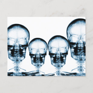 X-Ray Vision Skeleton Skull - Blue Postcard