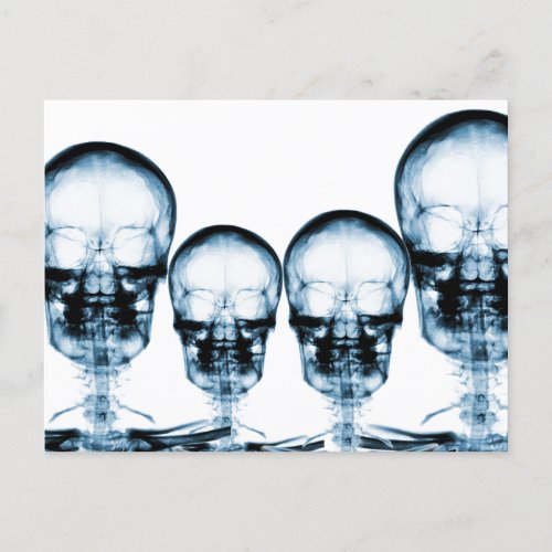 X_Ray Vision Skeleton Skull _ Blue Postcard